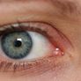 CloseUp